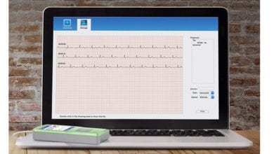 best portable ECG EKG monitor