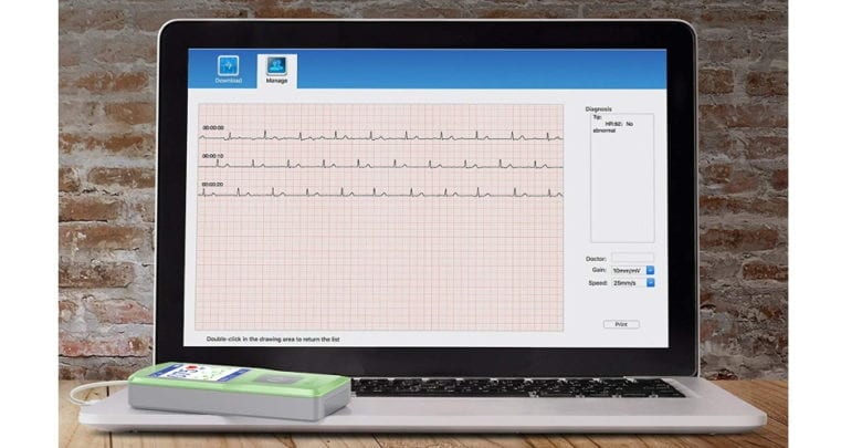 best portable ECG EKG monitor